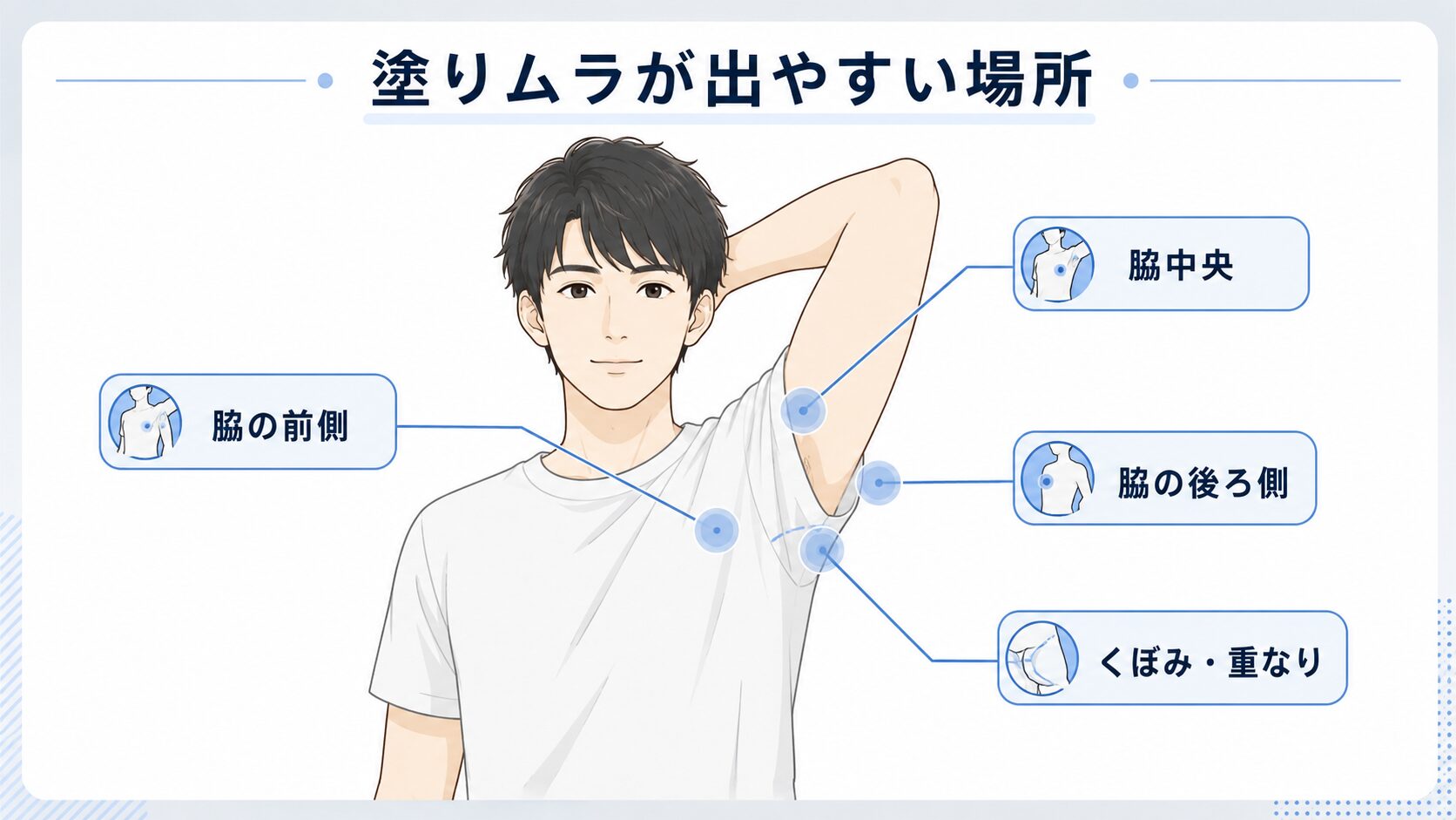 除毛クリームで塗りムラが出やすい脇中央・前側・後ろ側・くぼみを示した図解