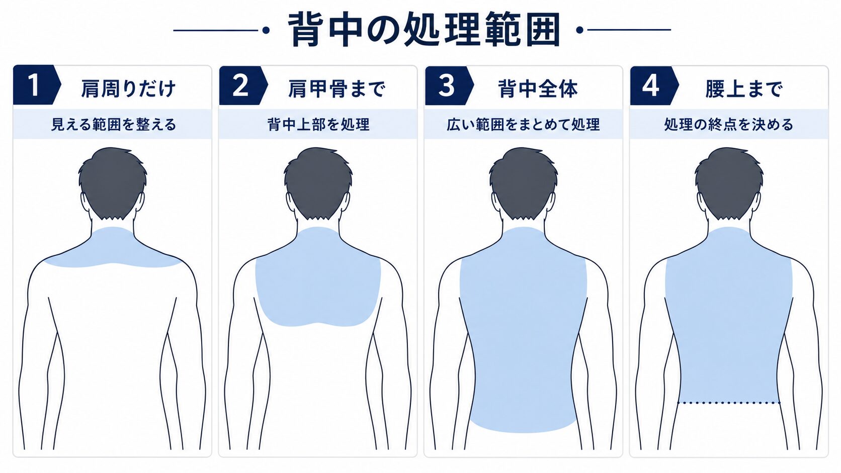 肩周り・肩甲骨まで・背中全体・腰上までの4つの背中毛処理範囲を比較した図解