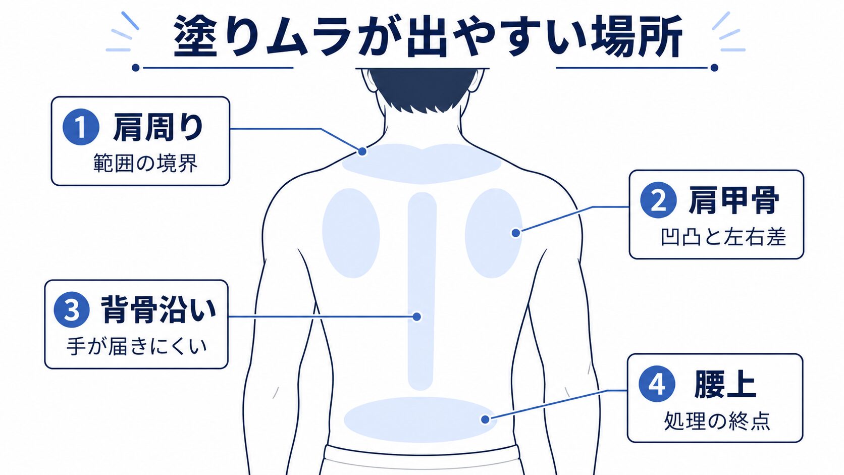 除毛クリームで塗りムラが出やすい肩周り・肩甲骨・背骨沿い・腰上を示した図解