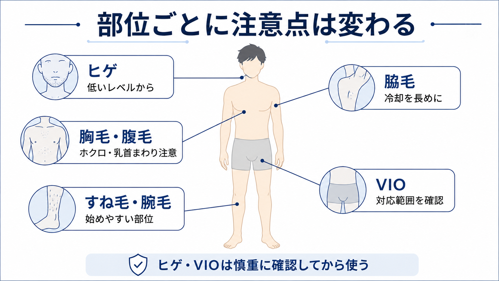 ヒゲ・すね毛・胸毛・脇毛・VIOなどケノンを男性が使う前の部位別注意点を示した図解